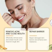 Ácido glicólico 7% tonificante cara reafirmante piel reduce los poros brillo Facial Control de aceite alivia el cuidado de la piel seca tóner ácido 240ml - details 6