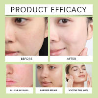 초빛빛 Pantenol alivia ligeramente las molestias de la piel facial Equilibra la esencia hidratante de aceite de agua - details 11