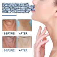 Retinol-Juego de suero Facial eliminador de arrugas, crema antienvejecimiento reafirmante instantánea, blanqueamiento de líneas finas, cuidado hidratante de la piel - details 21