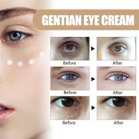 Crema para ojos eliminadora de gránulos de grasa, elimina las ojeras, bolsas para los ojos, desvanece las líneas finas, antihinchazón, arrugas, levanta el cuidado de la piel de los ojos reafirmante - details 11