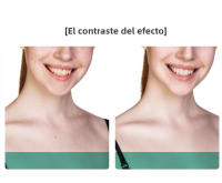 Masajeador de belleza, Instrumento de limpieza con luz en color, Lifting facial de Microcorriente y Reafirmante - details 7