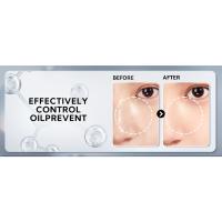 nose pore strips