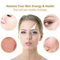Masajeador de ojos, Equipos cosméticos de frío y calor, Microcorriente EMS, Fotorejuvenecimiento - details 6