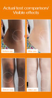Crema blanqueadora corporal, partes privadas, axilas, piernas, loción blanqueadora para rodillas, interior del muslo, íntimo, oscuro, elimina la melanina, ilumina el cuidado de la piel - details 4