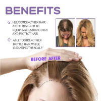 Las gotas de folículos reparan los folículos, nutren las raíces y cuidan el cabello grueso y firme - details 6