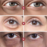 Crema eliminadora de ojeras, suero antienvejecimiento de Retinol, elimina las bolsas de los ojos, hinchazón, desvanece las arrugas, líneas finas, levanta el cuidado de los ojos firme - details 0