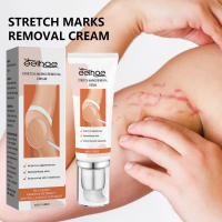 Desaliniza el cuerpo, reparación de cicatrices de embarazo, crema suave y nutritiva para el cuidado de la piel - details 1