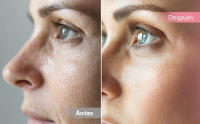 Aparato Radiofrecuencia Facial 5 en 1, Masajeador Facial Eléctrico Reafirmante, Limpieza Facial, Antiarrugas, Rejuvenecimiento, Radiofrecuencia Facial y Corporal Profesional - details 2