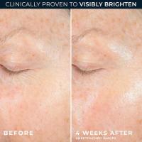 RoC Multi Correxion Revive + Glow 10% Vitamina C Blend Hidratante facial, crema en gel antienvejecimiento para un brillo instantáneo, hipoalergénica y - details 4