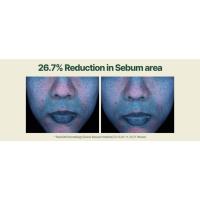 moisture serum