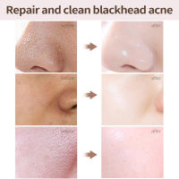 Crema para reducir los poros con ácido salicílico, crema para refinar los poros grandes, mejorar el acné facial, crema para eliminar puntos negros, Control de aceite antienvejecimiento, cuidado de la piel - details 1