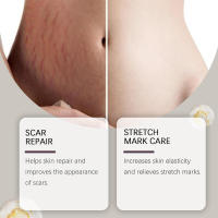 Aceite hidratante nutritivo para el cuidado de la piel corporal con vitamina E - details 5
