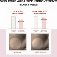 SKIN1004 Tónico transparente poremizante Madagascar Centella 7.1 fl.oz, 210 ml para queratina y pieles sensibles - details 4
