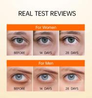 Crema de Ojos de Vitamina C JoyPretty Adiós a las Ojeras, Blanqueado, Firmeza y Suavidad - details 6