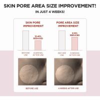 Skin1004 Madagascar Centella 7.1 fl.oz Suplemento transparente, 210 ml para queratina y pieles sensibles - details 4