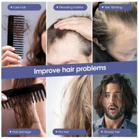 Cepillo de Masaje para Piel con Tecnología de Luz Azul y Roja Herramienta de Estilo Eléctrico para Prevención de Pérdida de Cabello y Crecimiento del Cabello - details 21