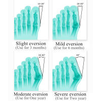 Separador de dedos de silicona EiD Hallux Valgus, almohadillas de juanete, esparcidor de corrección, Protector de pies, insertos para aliviar el dolor de dedos - details 9