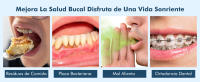 Irrigador Dental portátil Profesional, 350ML, Bucal Inalámbrico, 6 Boquillas, 5 Modos, Para Limpieza de Dientes - details 4
