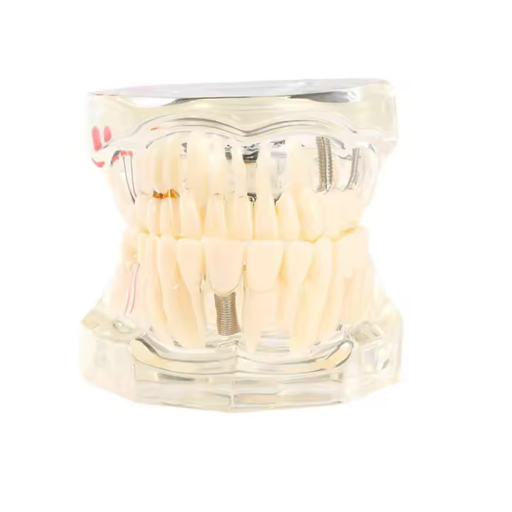 Modelos dentales Modelos removibles y restaurables de dientes enfermos para la enseñanza y la investigación en medicina y enfermedades dentales - 1