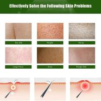 Crema de tratamiento para eliminar la piel de pollo, queratosis, cabello desigual, Reparación DE LA PIEL, poros, manchas, blanqueamiento opaco, crema hidratante para el cuidado del cuerpo - details 6