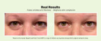 real results fade wrinkles fine lines brighten skin complexion hript patch test no irritation