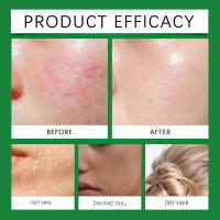 Oceanaura suaviza y piel, refresca el cabello, hidrata el gel de aloe. - details 6