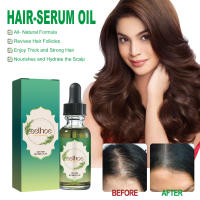 El romero nutre suavemente el cuero cabelludo, espesa, nutre, fortalece y solidifica el aceite esencial para el cuidado del cabello - details 1