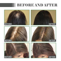 El aceite esencial puede reparar y proteger, mejorar las daños irritantes, fortalecer el cabello e hidratarlo. - details 8
