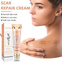 Crema corporal para eliminar imperfecciones de la piel, reafirmante, nutritiva, hidratante, uniforme, tono de piel, disminuir la pigmentación, cuidado corporal, 20g - details 0
