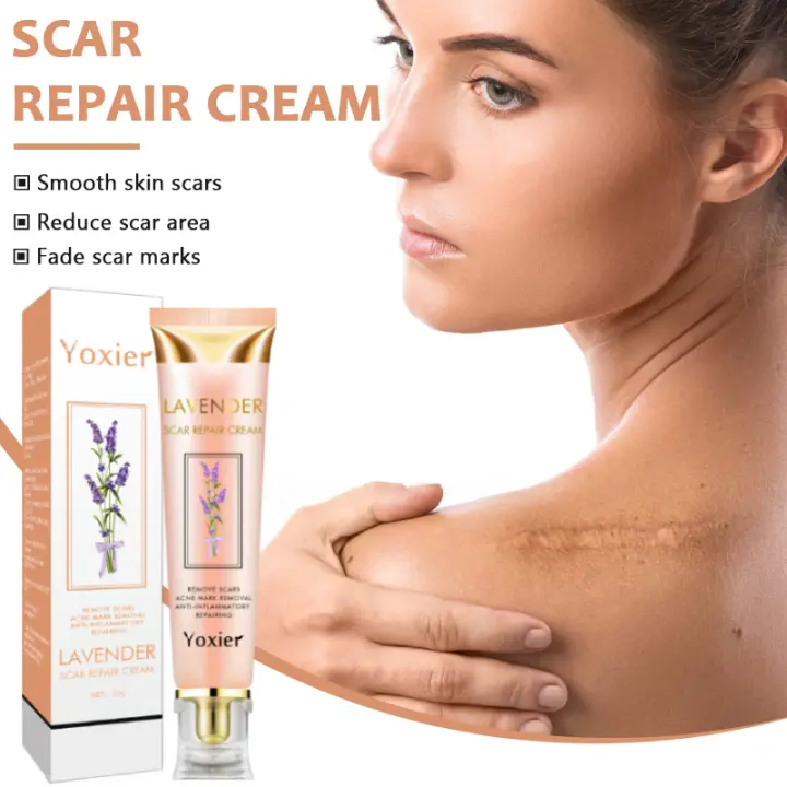 Crema corporal para eliminar imperfecciones de la piel, reafirmante, nutritiva, hidratante, uniforme, tono de piel, disminuir la pigmentación, cuidado corporal, 20g - 1