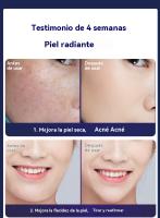 radiofrecuencia facial Página de inicio EMS micro corriente para apretar la piel de rejuvenecimiento fotónico instrumento inteligente de masaje facial y belleza masajeador Cepillo facial eléctrico - details 3