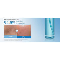 Medicube Zero Pore Blackhead Aceite de Limpieza Profunda para Todo Tipo de Piel, Limpiador Facial Hidratante Diario. - details 4