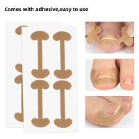 Pegatinas de Corrección de Uñas Herramienta de Cuidado de Piedras 4Pcs/8Pcs/12Pcs - details 4