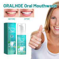 Mousse Oral Eliminación de manchas Blanqueamiento dental, Protección de las encías, Cuidado dental de belleza, Aliento fresco - details 1