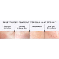 Anua Retinol Serum Anti-Age Soft para pieles con textura 0,11% Retinol, 5% Niacinamida - details 2