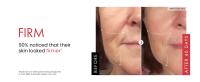 Crema para eliminar arrugas, Retinol, cara, antienvejecimiento, reafirmante, levantamiento, desvanecimiento, líneas finas, mejora la sequedad de la piel, hidratante, ilumina el cuidado de la piel - details 3