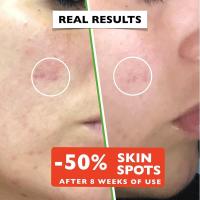Vitamina VC Cara Hialurónico Niacinamida Arrugas Envejecimiento Cuidado unisex - details 3
