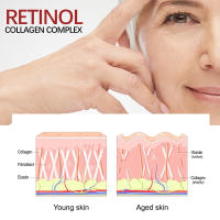 Bolsa para ojos instantánea, crema para eliminar ojos, líneas finas, partículas antigrasa, ojeras, hinchazón, levanta, ilumina el cuidado de los ojos coreano, nuevo - details 2
