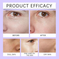 La crema hidrata, nutre, hidrata y reafirma profundamente la piel facial elástica. - details 8