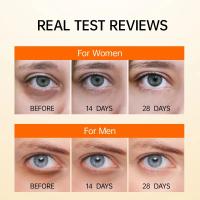 Crema para ojos antiojeras, elimina las bolsas debajo de los ojos, crema para apretar Vc, eliminación de arrugas, ojos, reafirmante, blanquea el cuidado de la piel, maquillaje de belleza - details 2