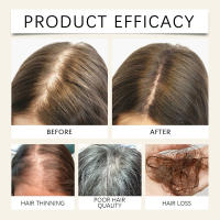 El spray de jengibre y romero repara el cabello seco, peludo, denso, suave y liso, previene la caída del cabello - details 8