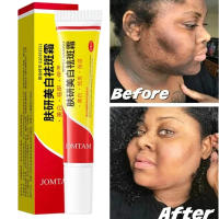 Whitening Freckle Cream Face Brightening Cream Niacinamide Reduce Chloasma Melasma Melanin Fade Fine Lines Lighten Dark Skincare - details 1