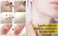 bee venom cream
