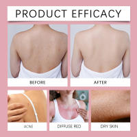 Vainilla Cuerpo Cuidado Suave Piel Hidratante Fragancia Aceite Esencial Calmante - details 8