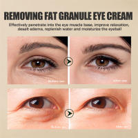 Crema para ojos eliminadora de gránulos de grasa, elimina las ojeras, bolsas para los ojos, desvanece las líneas finas, antihinchazón, arrugas, levanta el cuidado de la piel de los ojos reafirmante - details 10