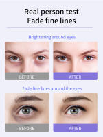 Crema Ocular Anti- Arrugas O'CHEAL Hidratante Secado Rápido con Bola de Rodillos - details 9