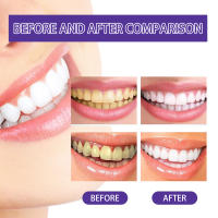 Purple refresca el blanqueamiento bucal, elimina las manchas amarillas, limpia y cuida la pasta de dientes - details 8