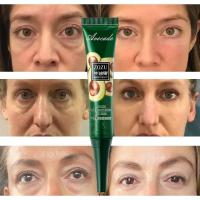 Crema de Ojos para Bujías Instantáneas Reducción de Arrugas, Desvanezimiento de Hinchazón, Reafirmación de Piel Blanca Bajo los Ojos Herramientas de Cuidado de la Piel Facial - details 0