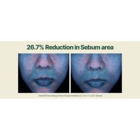 moisture serum