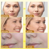 3 piezas de crema de veneno de abeja Botox para eliminar arrugas y reafirmante, hidratante, lifting y recuperación para todo tipo de piel, crema de veneno de abeja antienvejecimiento, crema hidratante facial - details 2